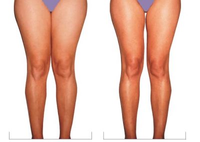 Odette’s Skin Laser Wellness Clinic